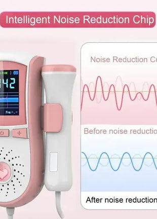 Fetal Doppler with Digital Screen, Independent Probe, Speaker, Pink White ABS Plastic, 2 AA Battery Powered